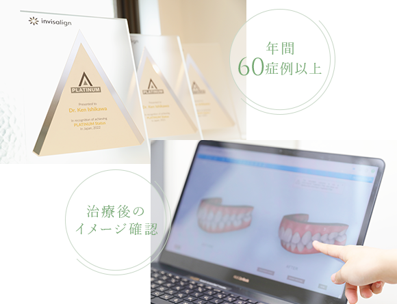 インビザライン認定医による精度の高いマウスピース矯正治療
