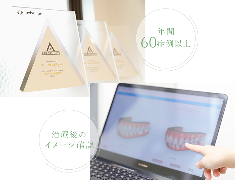 インビザライン認定医による精度の高いマウスピース矯正治療